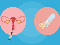 36岁肥胖女性做二代试管婴儿养囊成功率高吗？